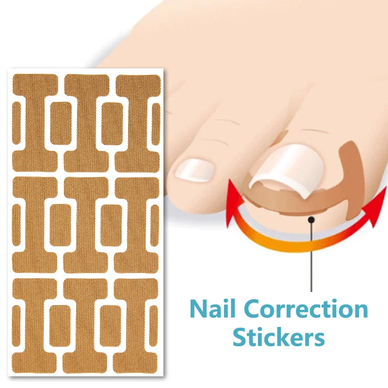 

42Pcs/Bag Nail Treatment Patch Anti Infection Paronychia Onychomycosis Ingrown Toe Nails Groove Fungus Correction Repair Sticker