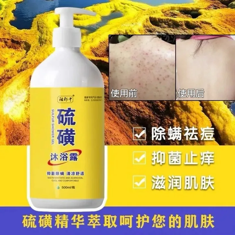 New Super 500ml Sulfur Liquid Soap Removing Mites Bath Gel Deep Cleaning Mites Removal Shower Gel Body Cleaning Health Care