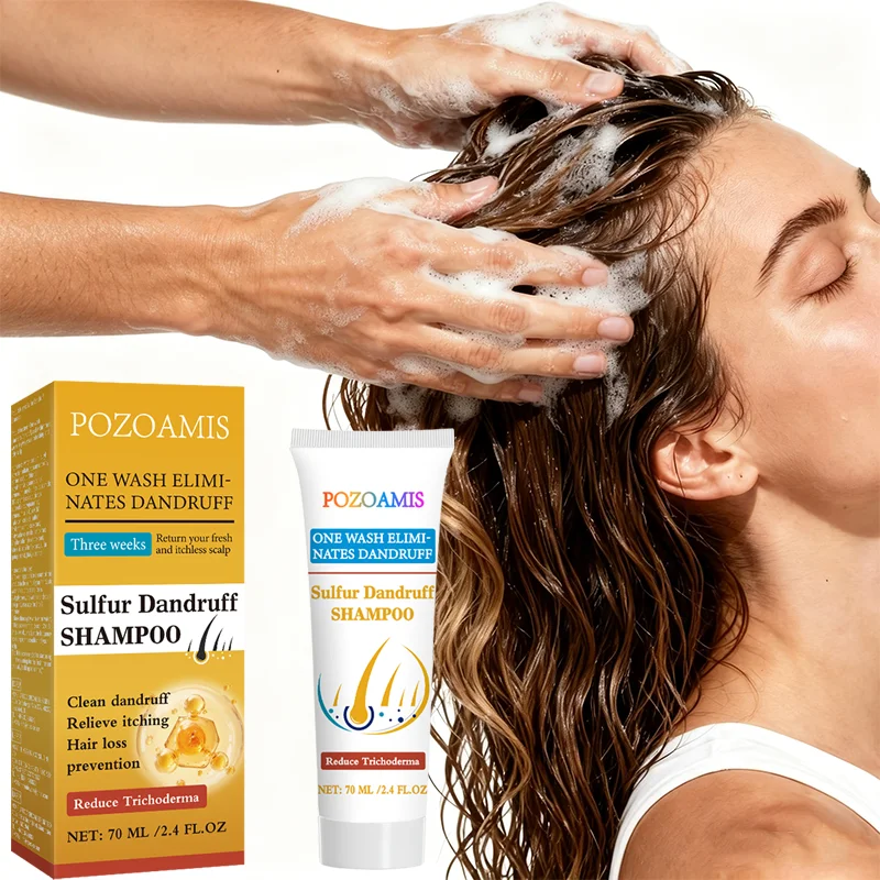Sulfur Dandruff Shampoo, Cleanses Dandruff, Relieves Itching, Reduces Hair Shedding, and Provides Long-Lasting Oil Control.