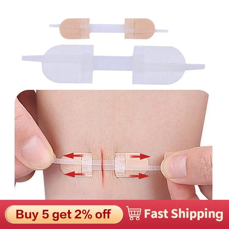 

Band-Aid Zipper Tie Wound Closure Patch Hemostatic Patch Wound Fast Suture Zipper Band-Aid Outdoor Portable