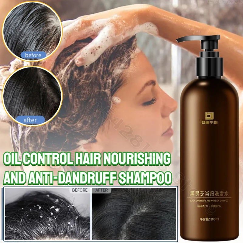 

Black Ganoderma Angelica Shampoo Oil Control Hair Nourishing Anti-hair Loss Shampoo Herbal Anti-Dandruff Shampoo 300ml