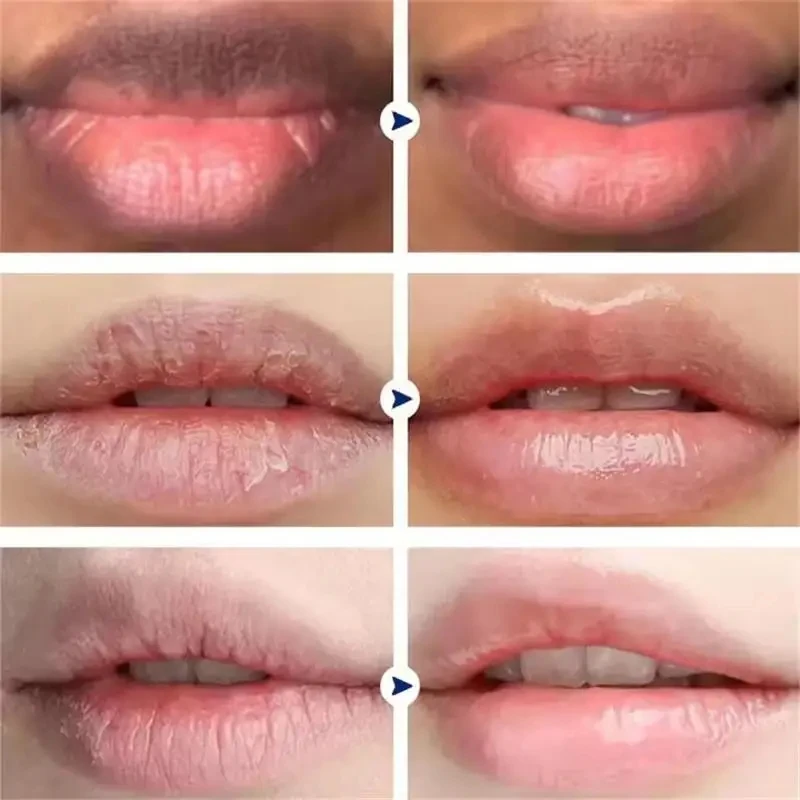 Remove Dark Lip Balm Lightening Melanin Mask Gloss Oil Exfoliating Clean Moisturizer Korean Care Makeup Beauty Health Products