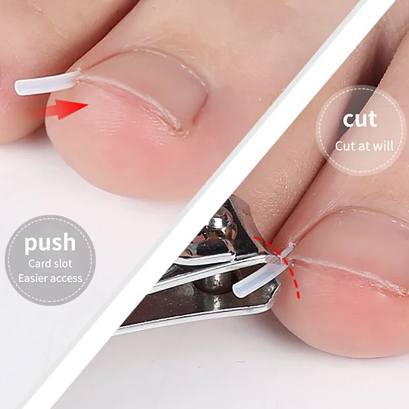 Ultradunne Ingegroeide Teennagel Corrector Gereedschap C-vormige Buis Pad Corrigeren Nagels Groei Paronychia Behandeling Herstellen Pedicure Gereedschap