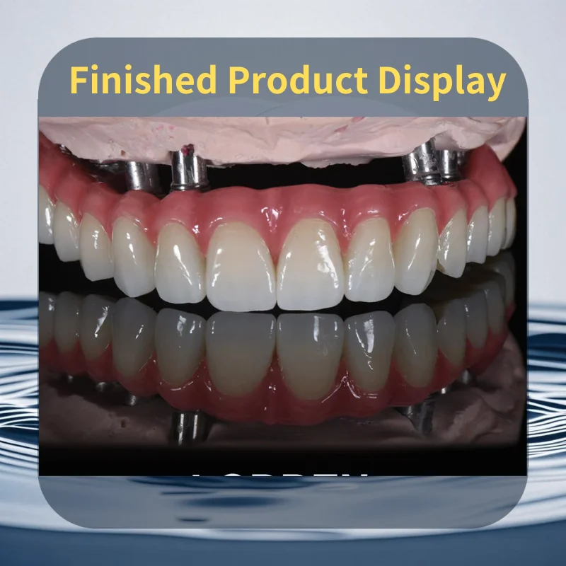 Рисунок 4 - Lodden 4D Pro Многослойные циркониевые