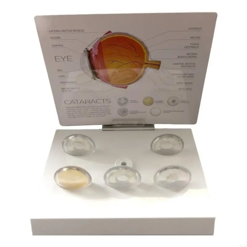 Menschliches pathologisches Augapfel Modell pathologisches Augapfel -Anatomie -Modell zum Unterrichten von Demonstration