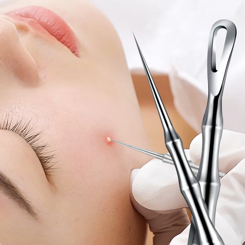 1/2/3 Uds. Pinza alemana ultrafina para espinillas, espinillas, Clip para espinillas, salón de belleza, herramienta especial para eliminar partículas de grasa y acné