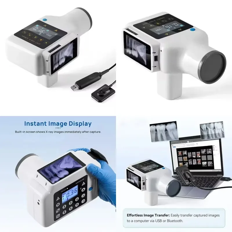Portable High Frequency Dental X Ray Machine with Digital RVG Sensor for Metal Radiography