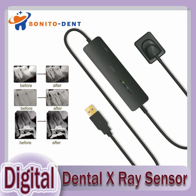 

Hot Sale Original HDR500/600 Digital Dental X Ray Sensor Oral X-ray Imaging System RVG Sensor