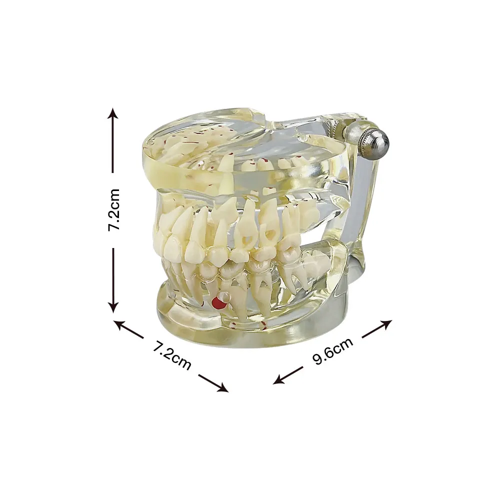 Dental Teaching Model Child Primary Teeth Mixed Dentition Model With Pathology Caries Dentistry Dentist Studying Pediatric Model