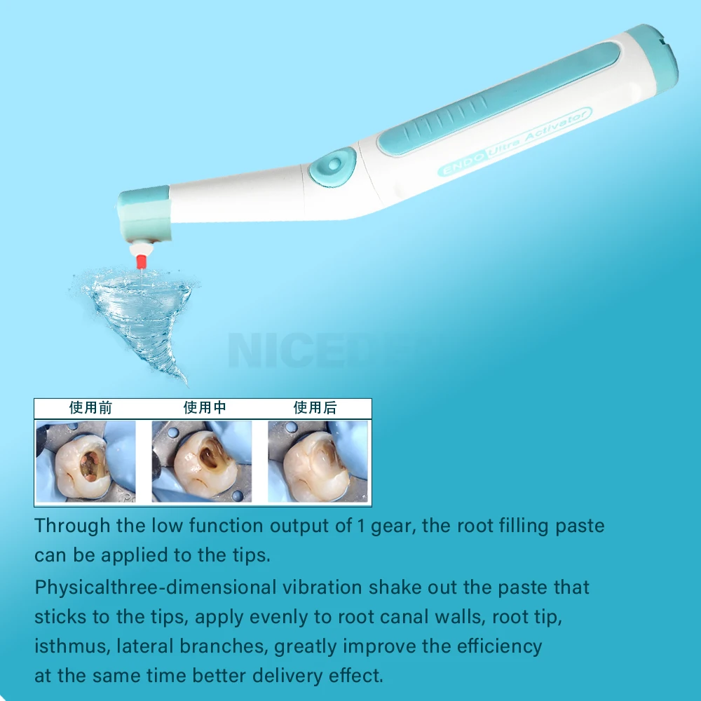 60 Tips Dental Wireless Ultrasonic Activator Endo Ultra Activator Washing Tooth with USB Recharged Battery Dentistry Tools