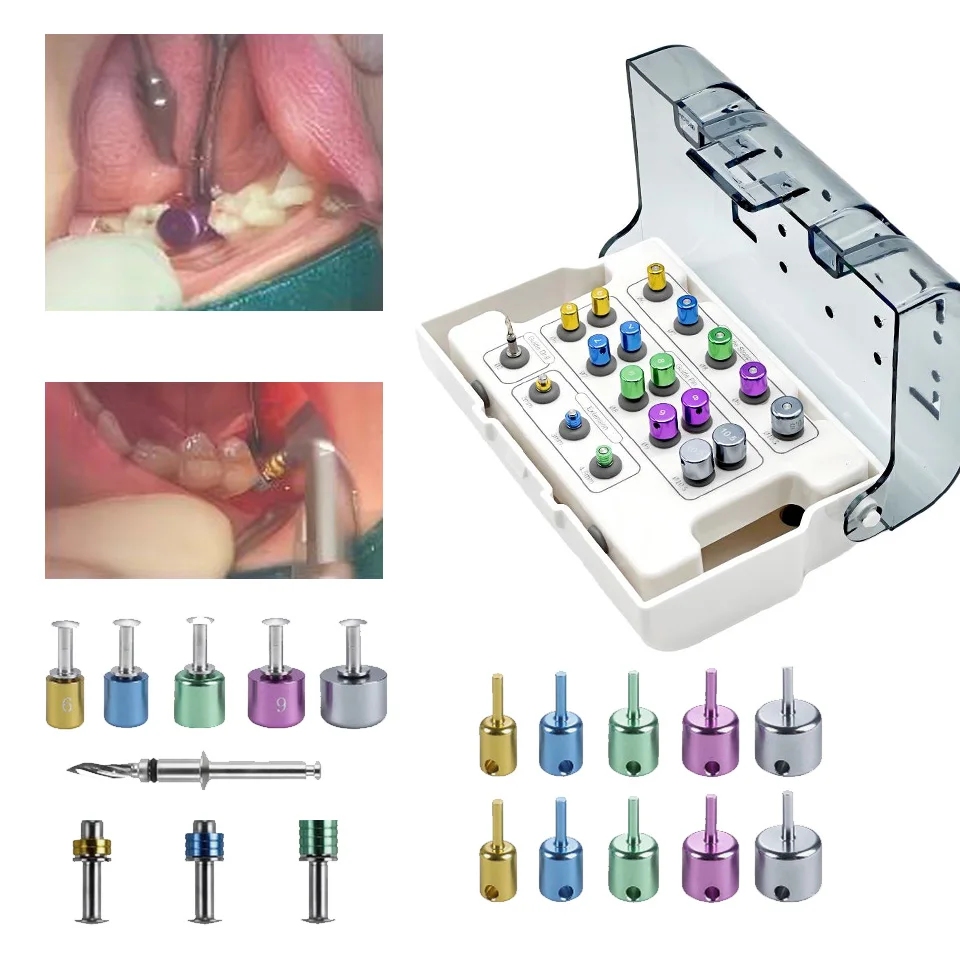 Universal Dental Implant Fully Guided Drills Set Titanium Surgery Pin Positioning Guide Drill Stop Sleeves Dentistry Box