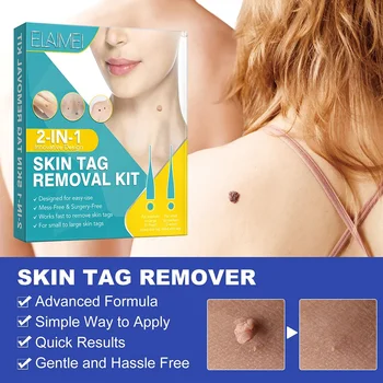 Double Sided Wart Treatment Face Skin Tag Removal Tool Acne Tag Remover Face Skin Tag Removal Patch 1