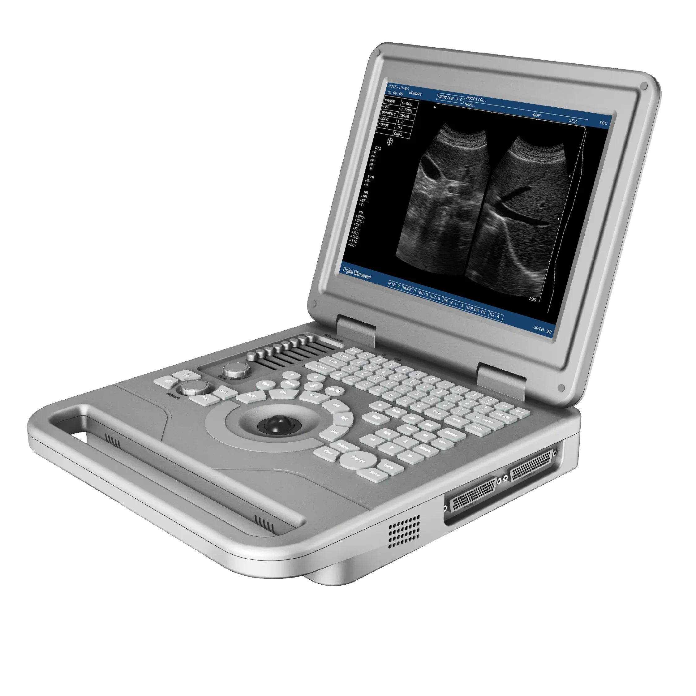 12.1 inch Hospital Equipment laptop medical ultrasound machine handheld device with Scanner price