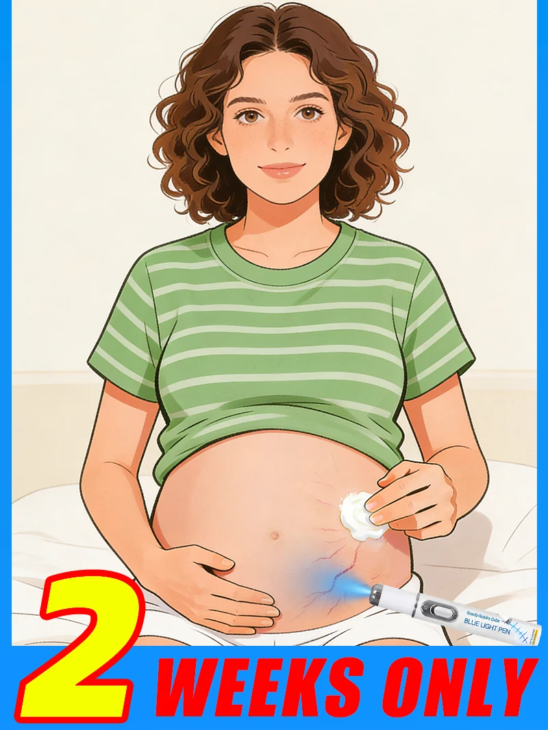 

Новая ручка-аппарат 2026 года с синим светом для устранения растяжек, инструмент для ухода за кожей после родов