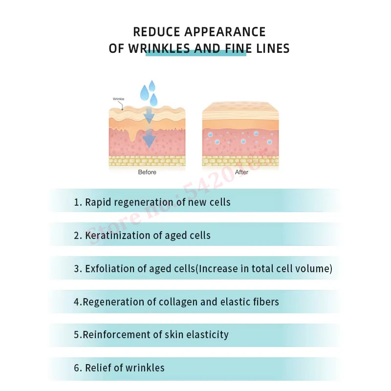 3%  EGF Repair Nicotinamide Serum Acne & Blackhead Removal Renewed Clear Skin Care Aging and Wrinkle For Face Essence