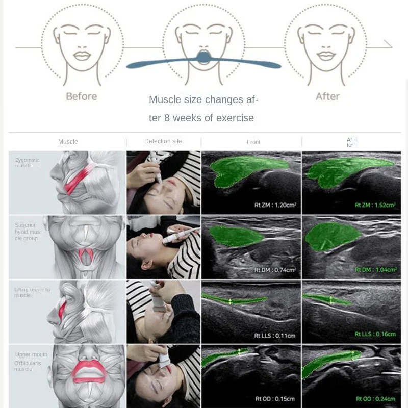 Bite Muscle Training Face-lift V Face Thin Face Artifact Nasolabial Wrinkle Remover Double Chin Reducer Face Lift