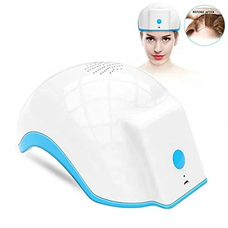 Factory Direct 272 Diodes Red Light Laser Hair Growth Helmet Portable Anti Hair Loss Therapy For Head With US & CN Plugs