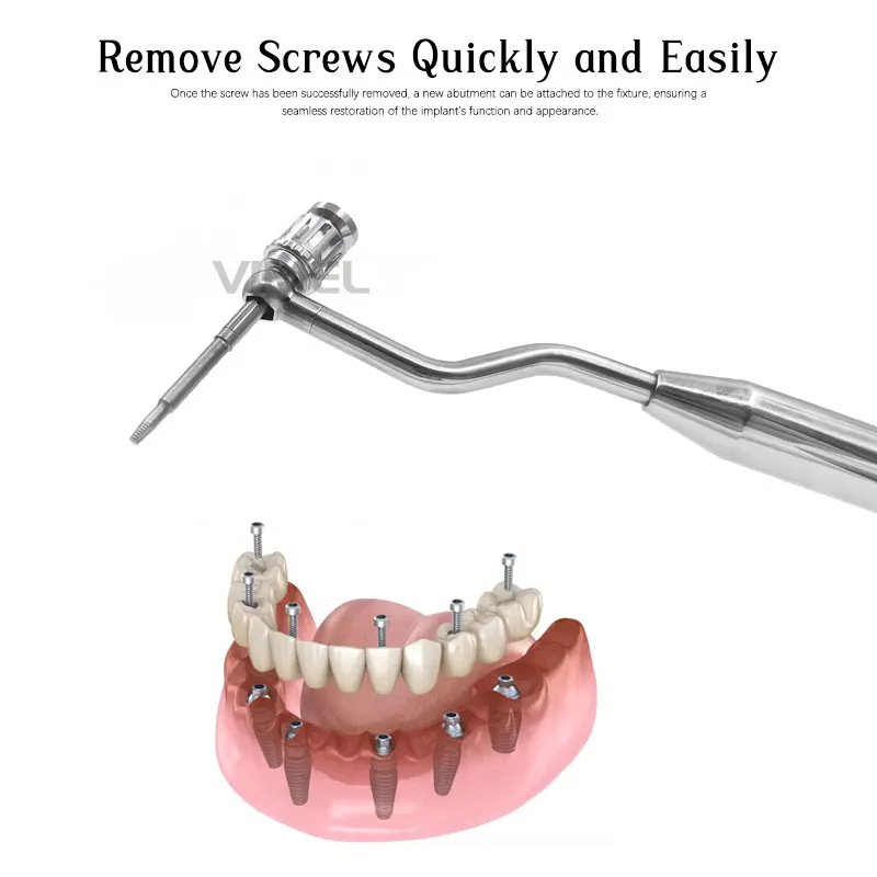 2024 New Dental Screw Drivers Romover Kit Stainless Steel Dental Implant Wrench Tool Kit