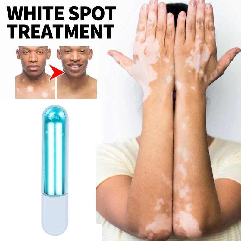 11nm UV light Treatment medical device Psoriasis Uvb treatment lamp home vitiligo device 3