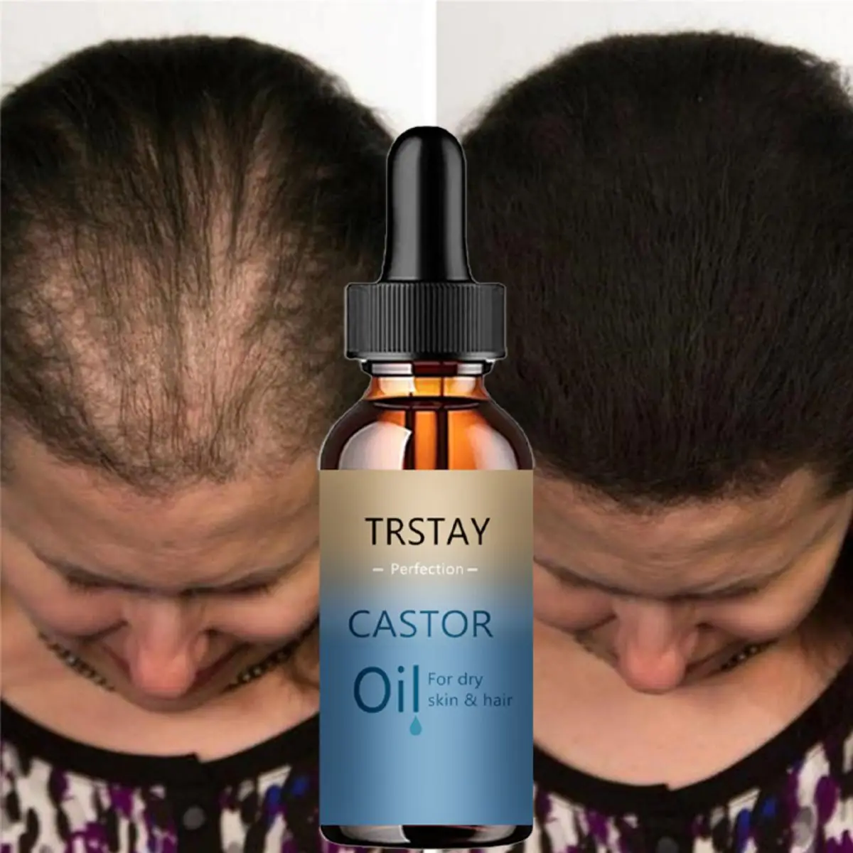 TRSTAY New Arrivals Eyebrow Growth Serum Essential Oils Eyelash Essence Castor Oil Beard Growth Essence Rapid Growth