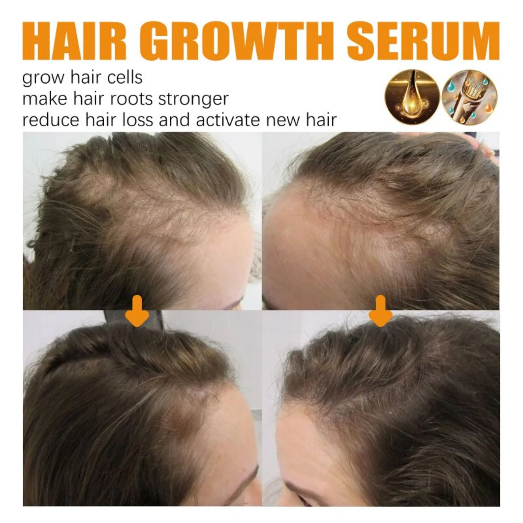 Anti Alopecia Fast Hair Growth Oil Essential Oils Essence Anti Loss Bald Treatment Scalp Massage Serum Hair Thickening