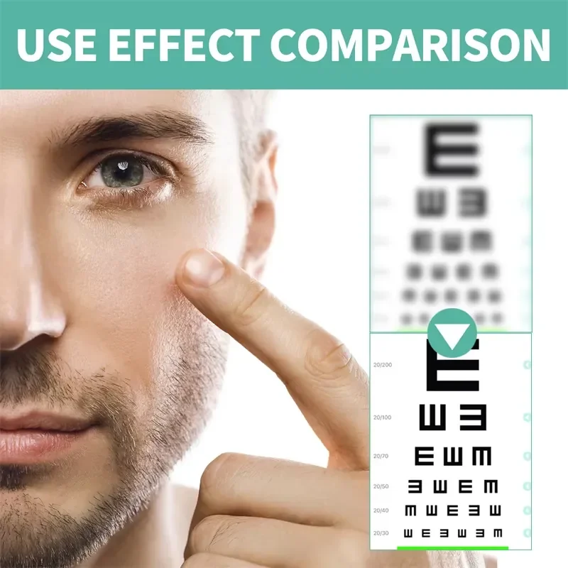 【CHIMU HOME】🌱 Fatigue Relieving Eye Massage Roller for Vision Nursing Relief Portable Acupoint Stimulation Device view 4