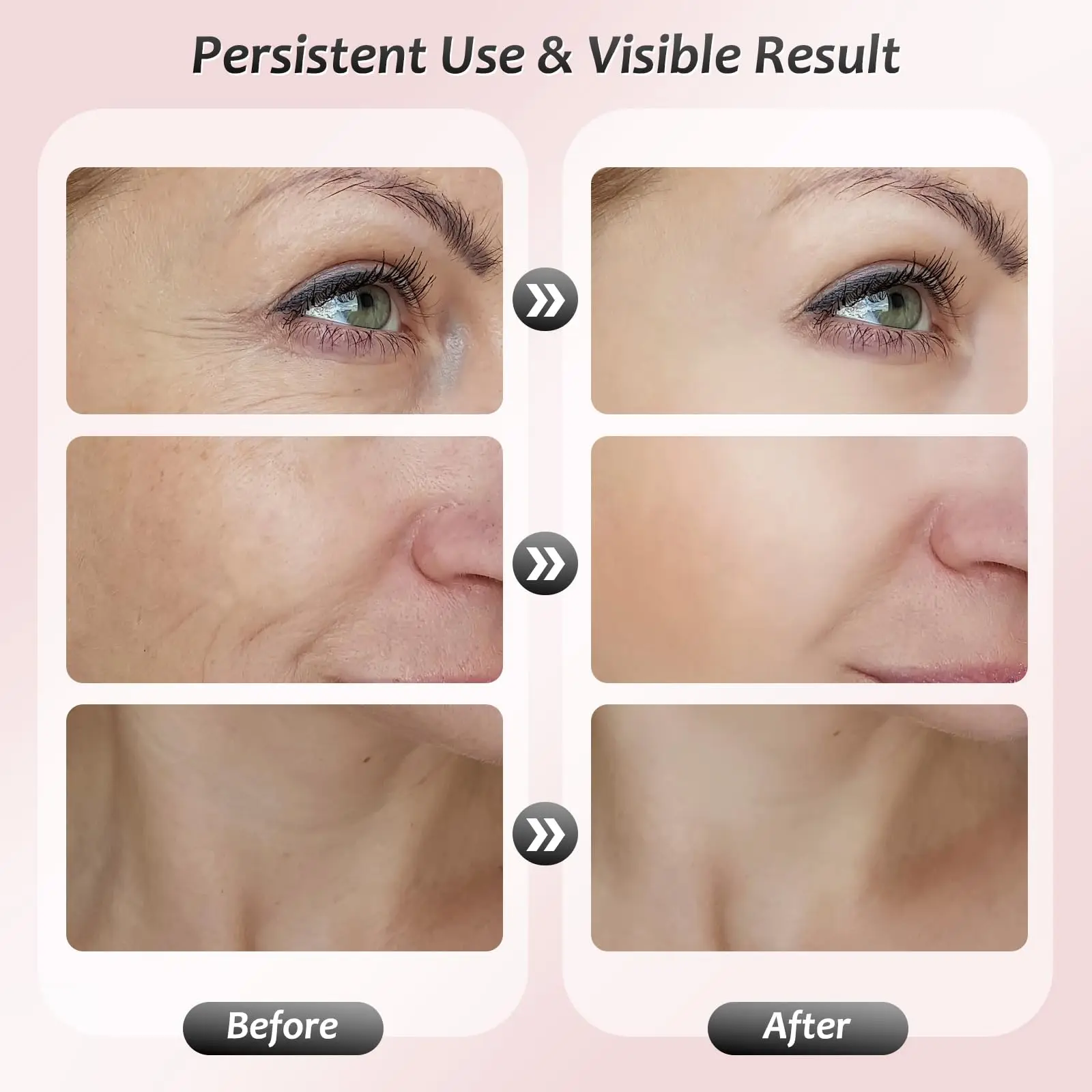 Ferramenta massageadora facial, massageador facial de 7 cores, massageador facial e de pescoço, ferramenta multifuncional de cuidados com a pele facial, massageador facial e pescoço