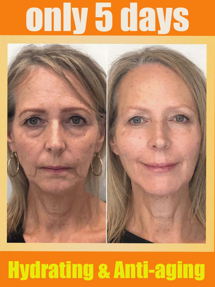 

No wrinkles presenting a youthful look