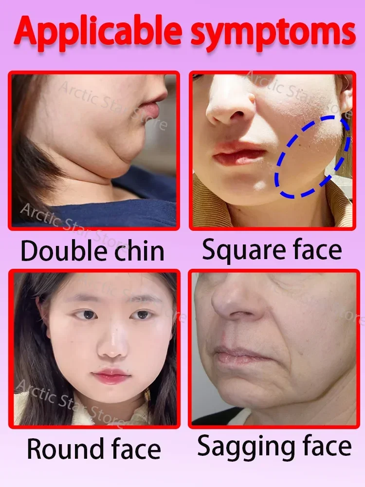 nice ครีมหน้าผอมที่มีประสิทธิภาพ Miracle Product V Series Skinny Face Double Chin Remover ครีมยกคางสองชั้น