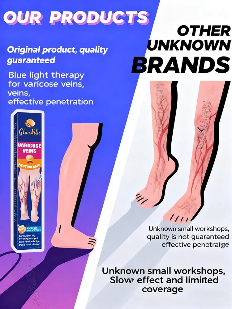 Spataderen verbeterd in slechts één week Lichaamsverzorging bevorderen de bloedcirculatie