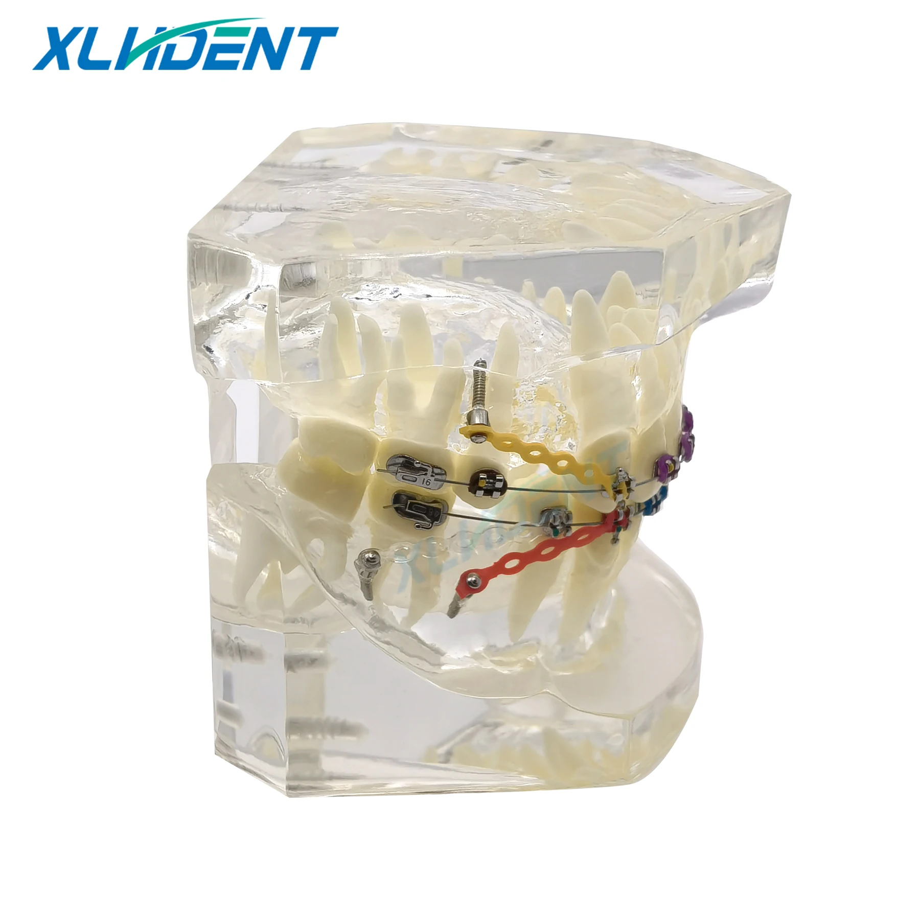 نموذج طب الأسنان مع قوس تقويم الأسنان للطبيب المريض الاتصالات علاج طبيب الأسنان نموذج مظاهرة نموذج طقم أسنان