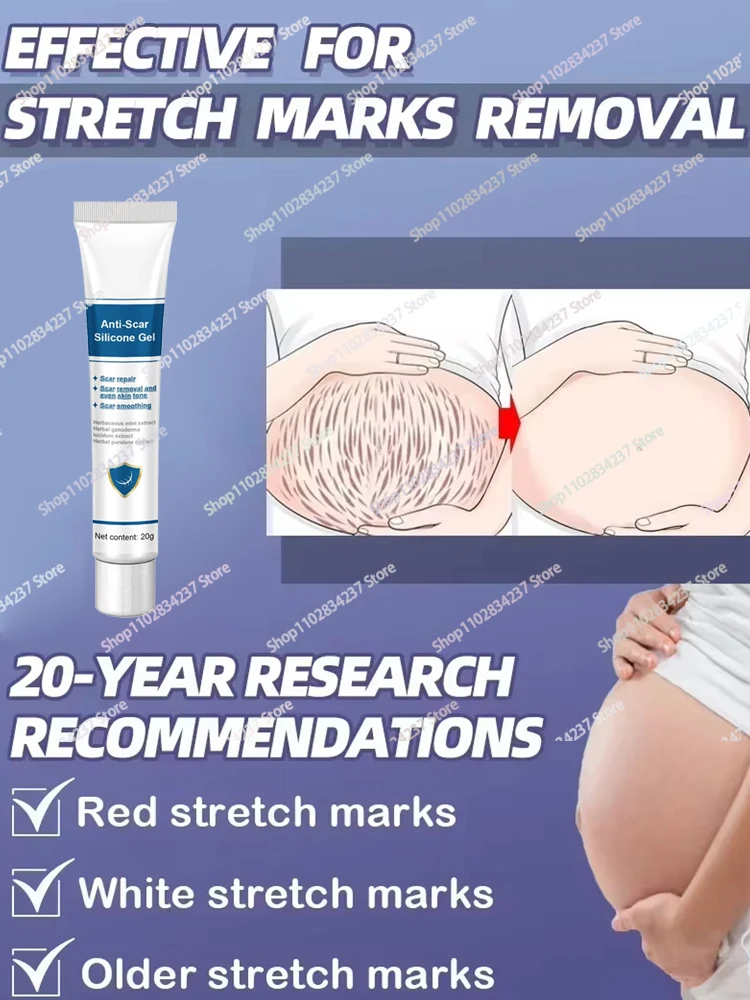 Fast Stretch Mark Remover Permanent Stretch Mark Removerstretch marks