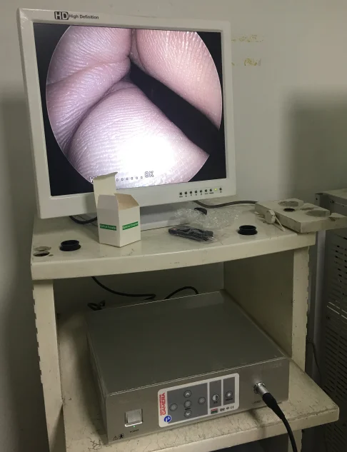 thumb