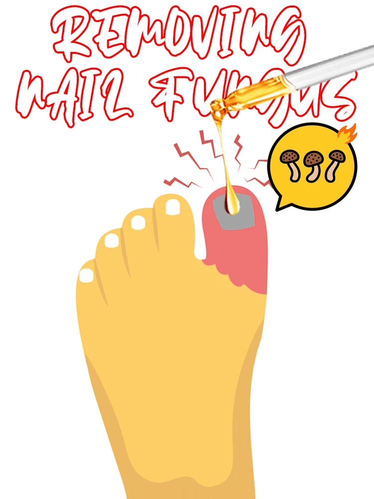 

Rejuvenator - Fungus Prevention Technology - Adjustable Temperature Control & Safety Sensor