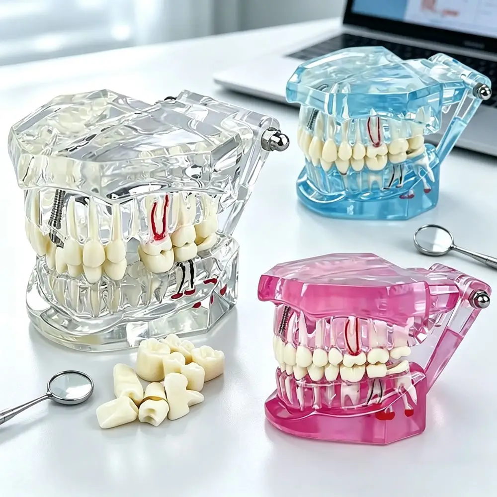 Dental Implant Training Model Removable Teeth With Pathology Demo For Bridge Restoration Implant Practice Teaching