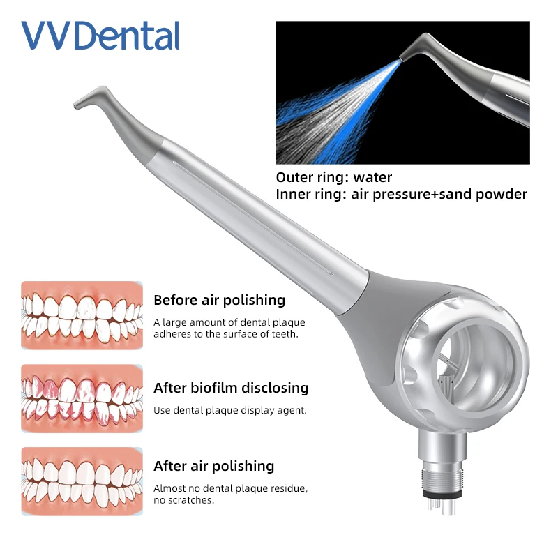 VVDental Sandblasting Air Polisher Air Flow Bicarbonate Jet Teeth Stain Removal Spray Gun Oral Hygiene Cleaning Tool