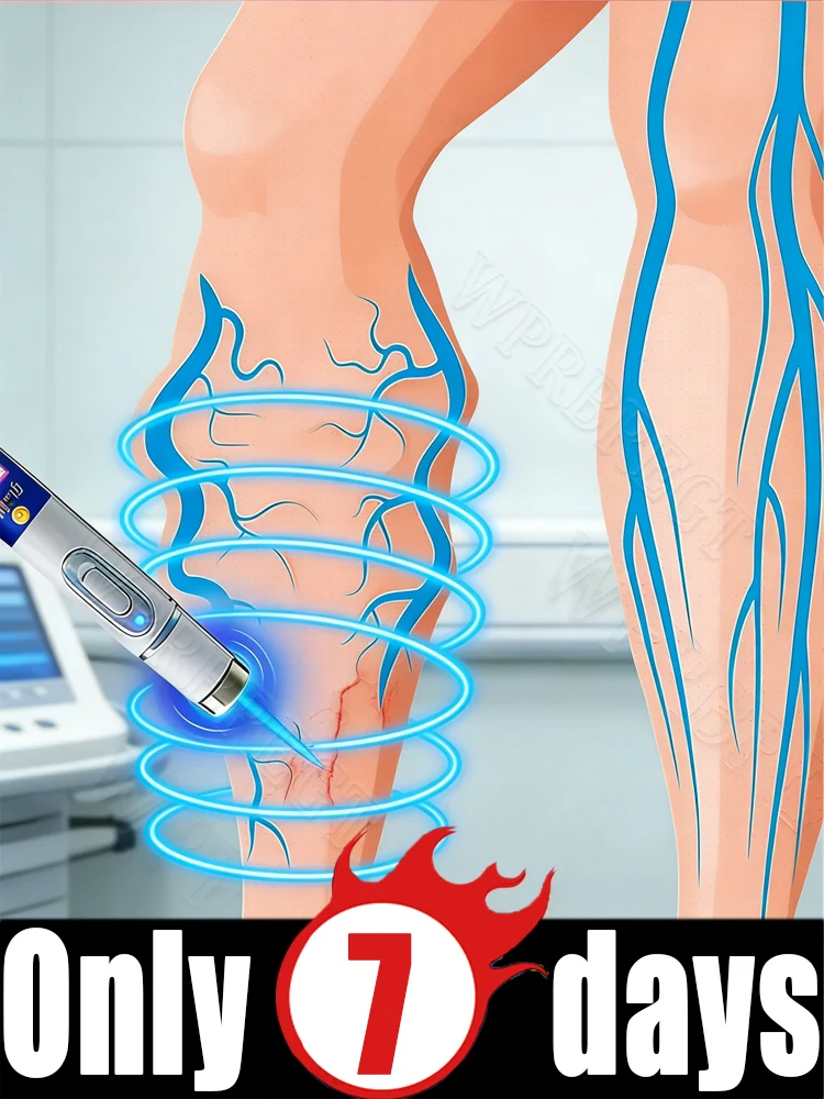 

Iᴛᴄʜɪɴɢ ᴀɴᴅ ᴘᴀɪɴ ᴄᴀᴜsᴇᴅ ʙʏ ᴠᴀʀɪᴄᴏsᴇ ᴠᴇɪɴs