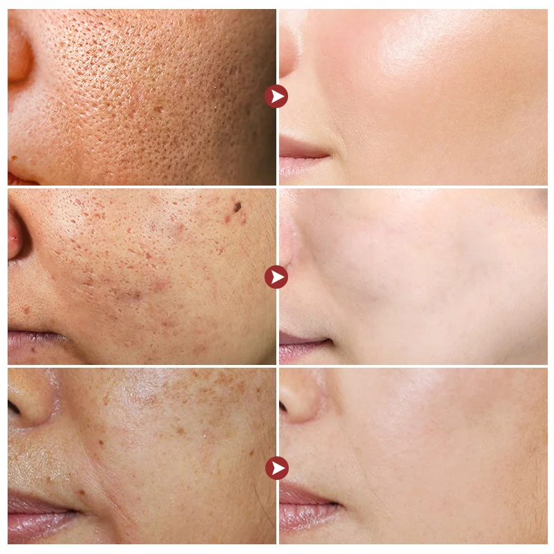 Serum pemutih wajah beras putih, Set perawatan kulit pelembab menghilangkan kerutan garis halus mengecilkan pori-pori memudarkan Melanin mencerahkan