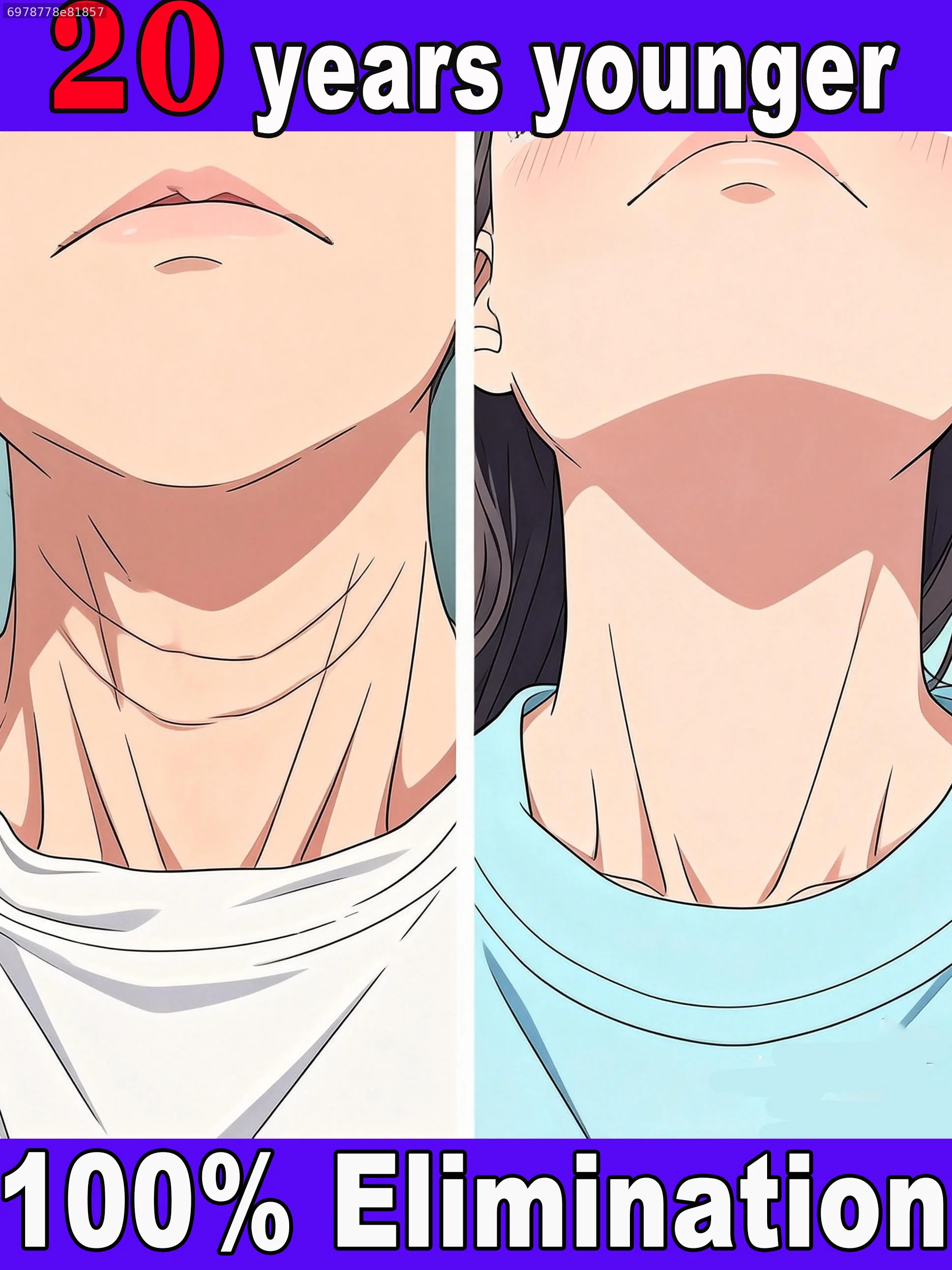 

Skin won't Regress by 2026 Nᵒ Wʳⁱⁿᵏˡᵉˢ