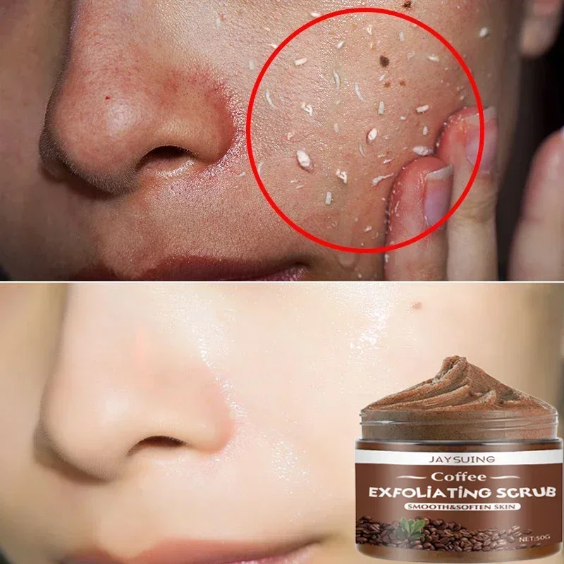 Coffee Face Exfoliating Cream Whitening Remove Dead Skin Blackhead Body Scrub Cleaner Anti Cellulite Acne Treatment Moisturizer