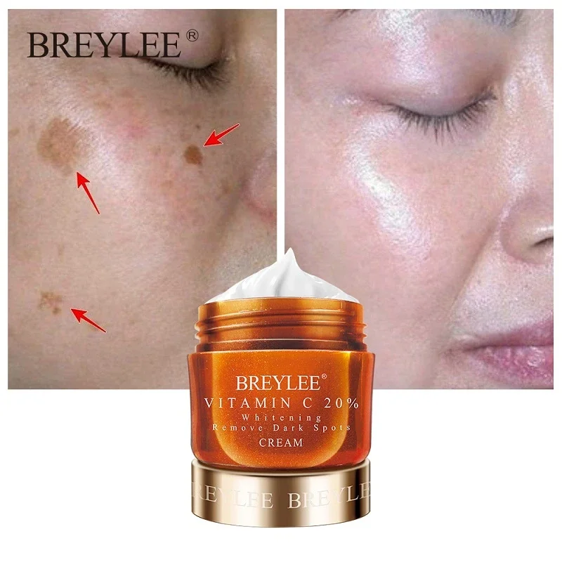 BREYLEE Vitamin C 20% VC Bleaching Gesichts Creme Reparatur Verblassen Sommersprossen Entfernen Dunkle Flecken Melanin Entferner Aufhellung Gesicht Creme