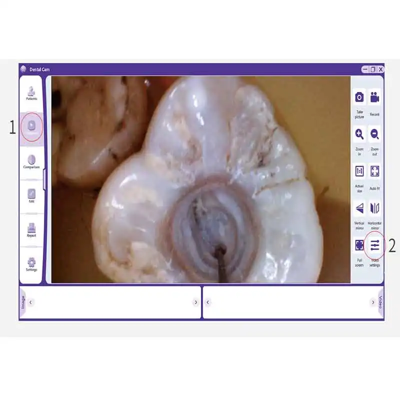 Dental Intraoral Camera with Monitor Intraoral Camera Memory Card Dental Dental Endoscope