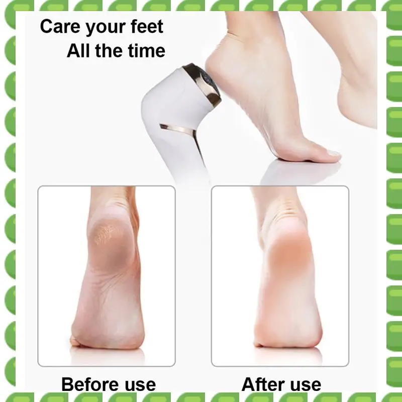 

A04V электрическое средство для удаления мозолей для ног портативный набор для педикюра перезаряжаемая водостойкая пилка для ног уход за ногами средство для удаления омертвевшей кожи