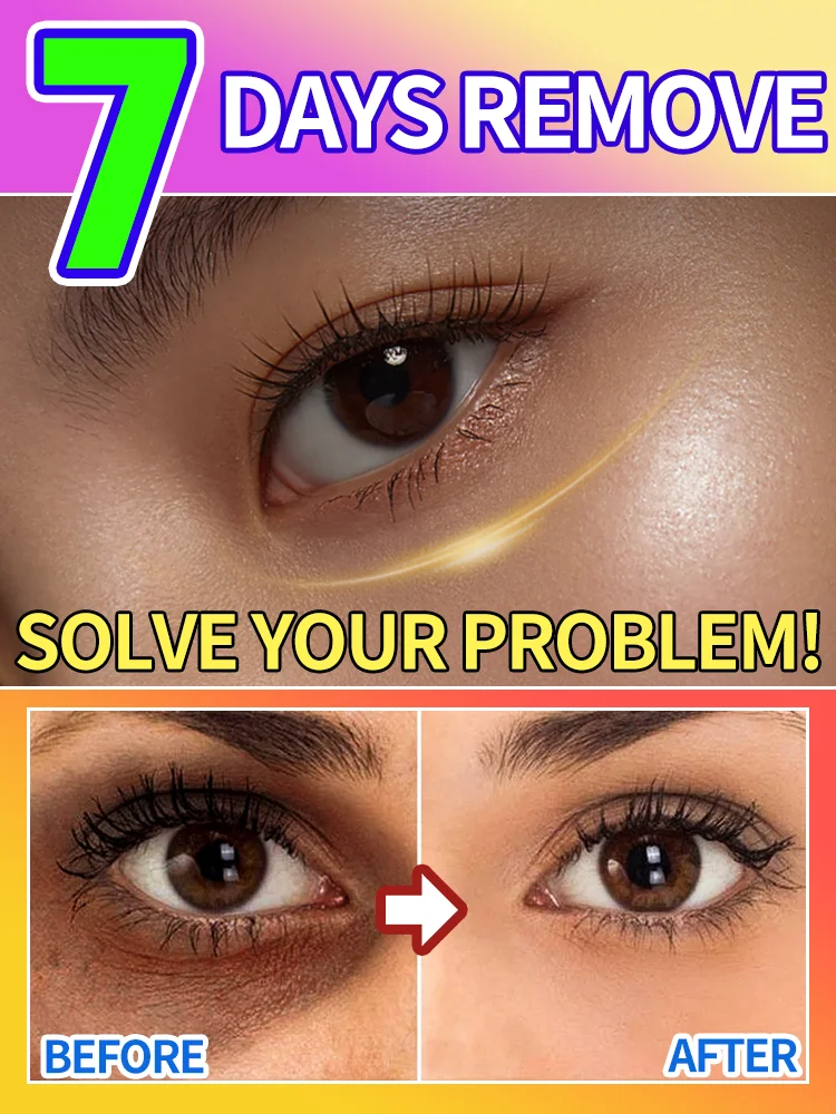 

Solve all your problems