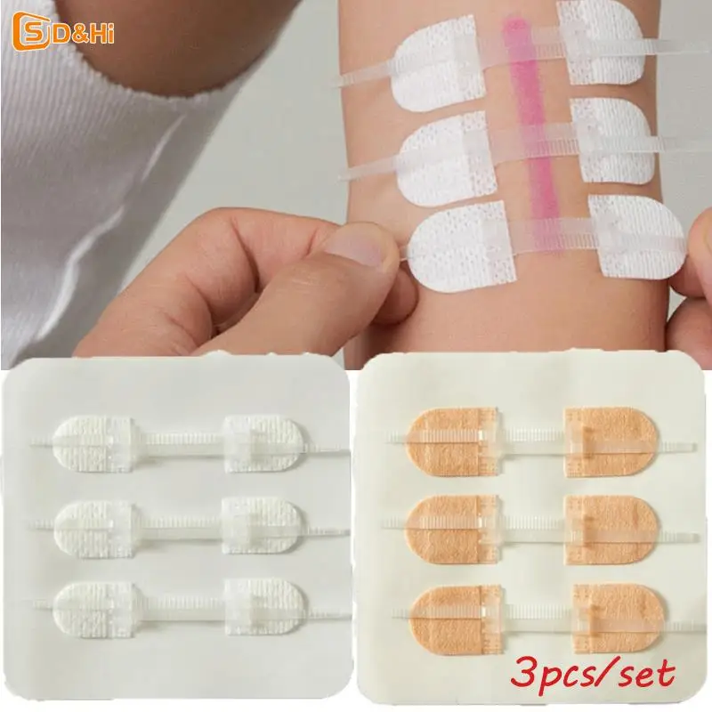 Band-Aid ritsleting dasi penutup luka Patch hemostatik Patch luka cepat menjahit ritsleting Band-Aid luar ruangan portabel