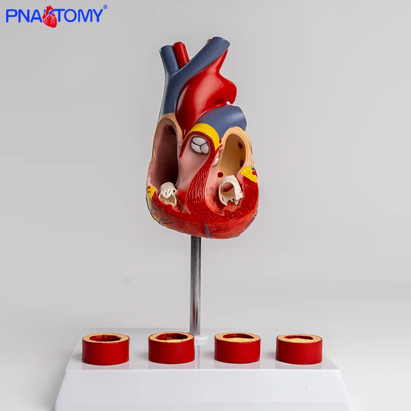 

Heart Thrombus Model Anatomically Dissectable Teaching Simulation Natural-sized Heart Thrombus Vascular Model
