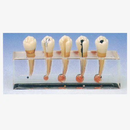 Clinical Model of Endodontics, Dental Care Model