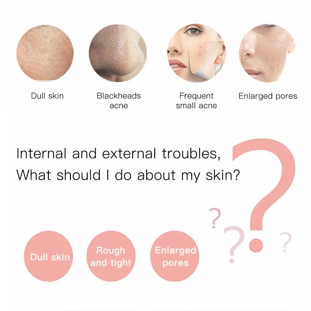 Elektrische Huid Scrubber Comedondrukker Dode Huid Acne Scalper Trillingen Facial Schone Porie Krimpen Gezicht Spatel Schoonheid Apparaat