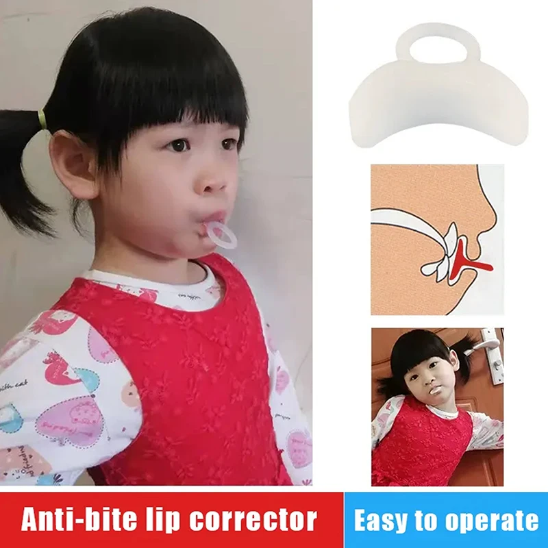 1PCS Lip Bite Prevention Device Stop Biting Lip Corrector Improve Oral Correct Facial Muscle Training Mouth Breathing Corrector