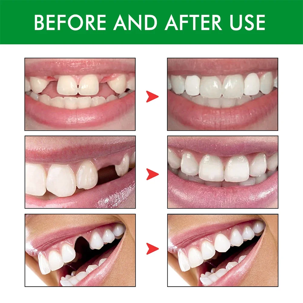 Dentistry Materials Teeth Solid Glue Resin for Fix The Missing Broken Tooth Dental Tools Solid Gel with Teeth Replacement Kit